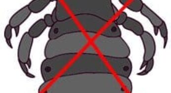 I Pidocchi Riconoscerli Ed Eliminarli